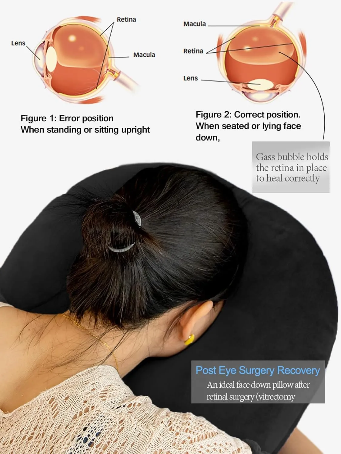 Face Down Pillow After Eye Surgery, Adjustable Height Prone Prone Pillow Face Down Sleep, Retina Lying Pillow, Vitrectomy Macular Hole Retinal Detachment Recovery Equipment Eye Surgery Support